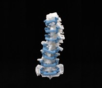 SpineGuide group image