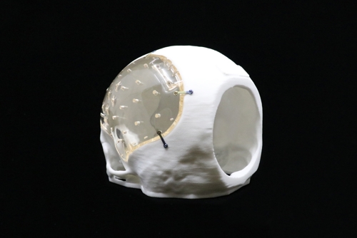 Neurosurgical Solutions