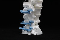 SpineGuide Carousel Image 2